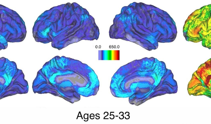 Brain Activity