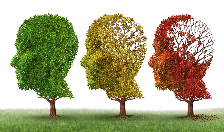 alzheimers-three-heads