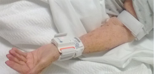 Arm test