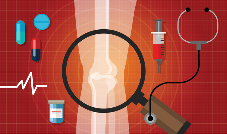 arthritis