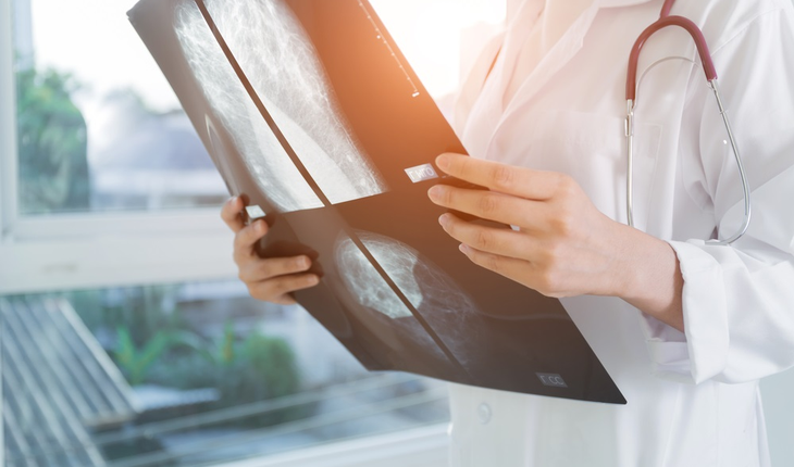 Doctor looking at mammogram x-ray
