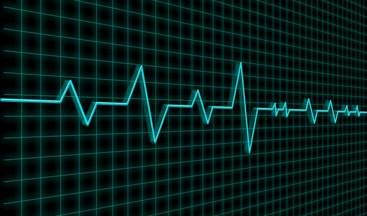 Electrocardiogram reading