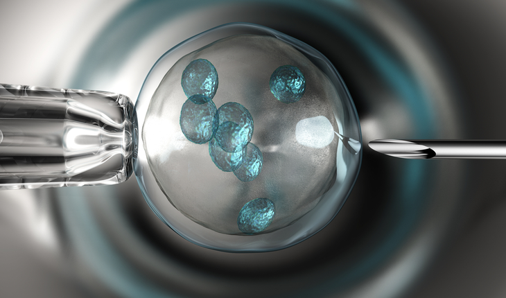 FertilityTreatmentBeyondTraditionalIVF