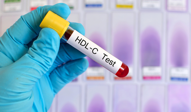 HDL cholestrol