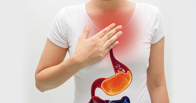 Woman with Acid Reflux