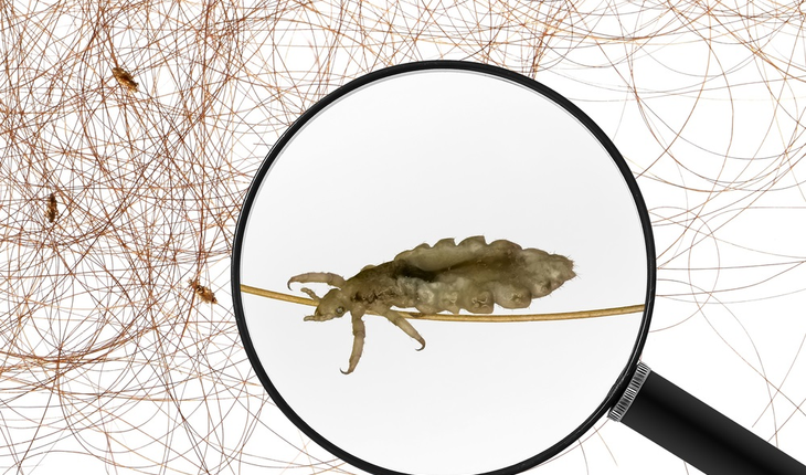 head-lice