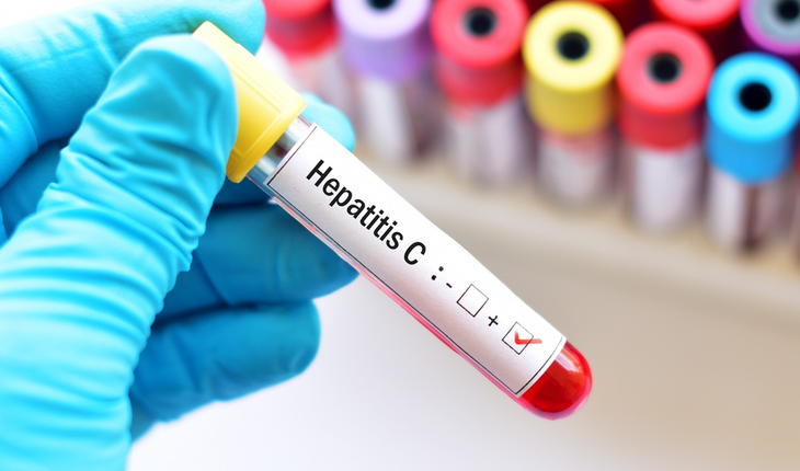 hepatitis-c-blood-samples