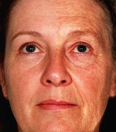 Older Woman Face