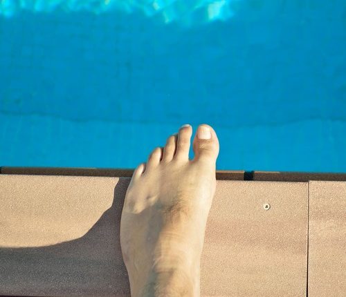 Toe Nail Fungus