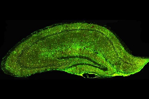 astrocytes