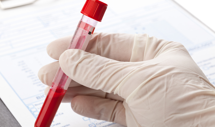 blood-sample-liquid-biopsy
