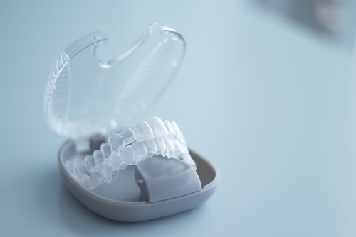 braces-for-teeth