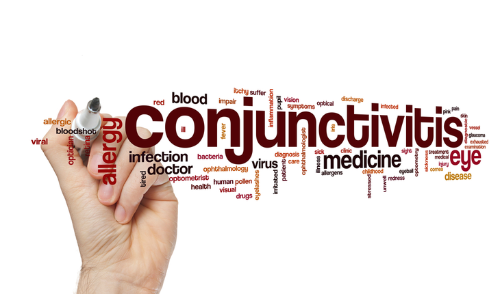 conjunctivitis