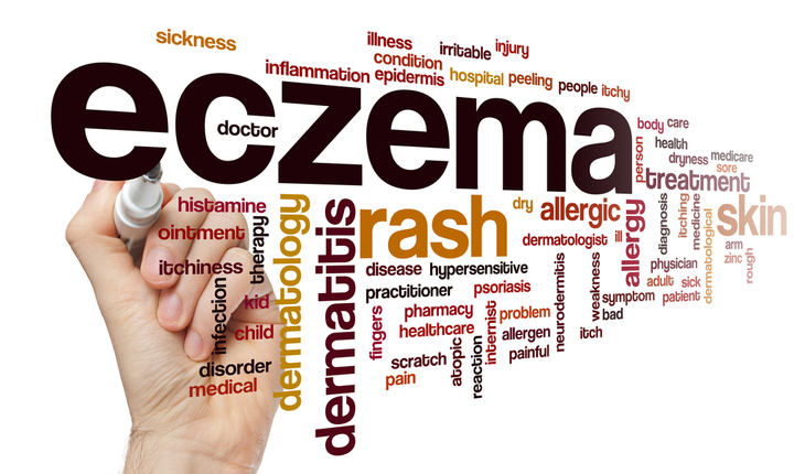 eczema