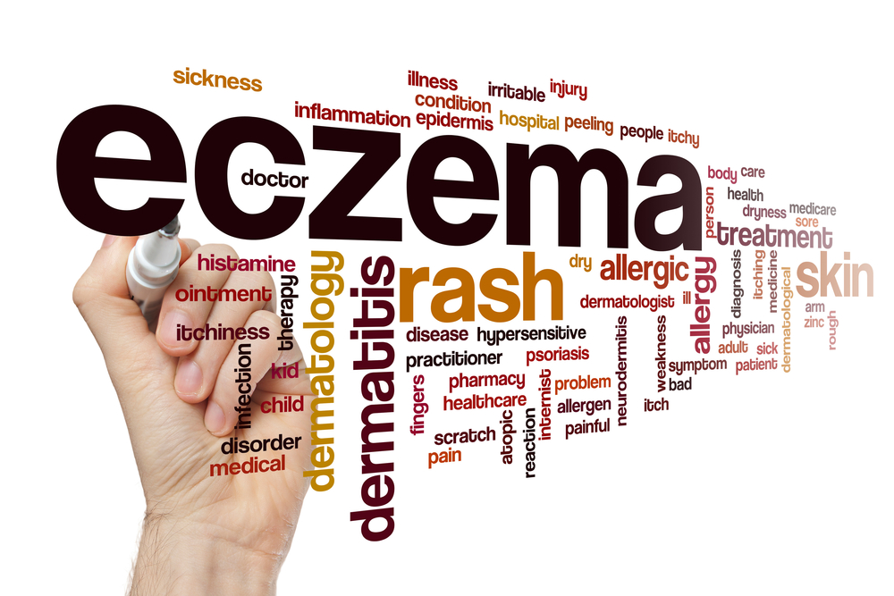 eczema.jpg
