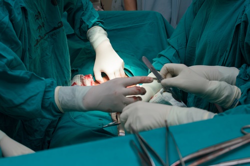 gynecological-surgery