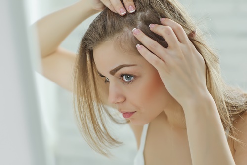 Hair Loss