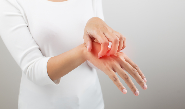 hand rash