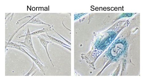 senescence