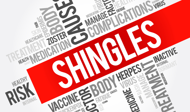 shingles