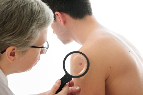 skin exam man