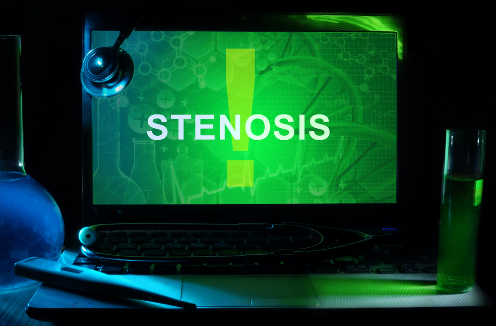 stenosis.jpg