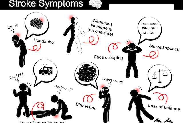 stroke-symptoms-graphic