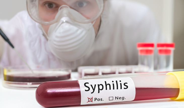 syphillis