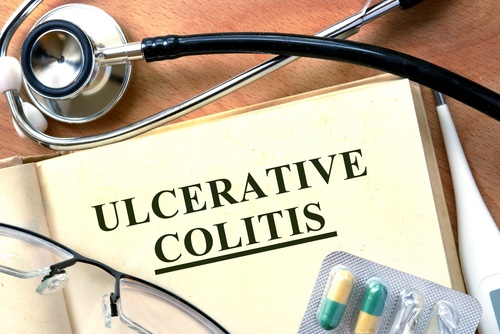 ulcerative-colitis.jpg