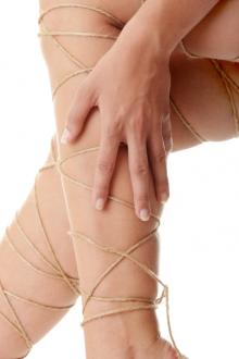 varicose-veins.jpg