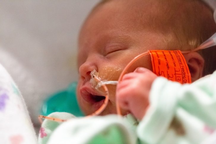 baby in an intensive care unit