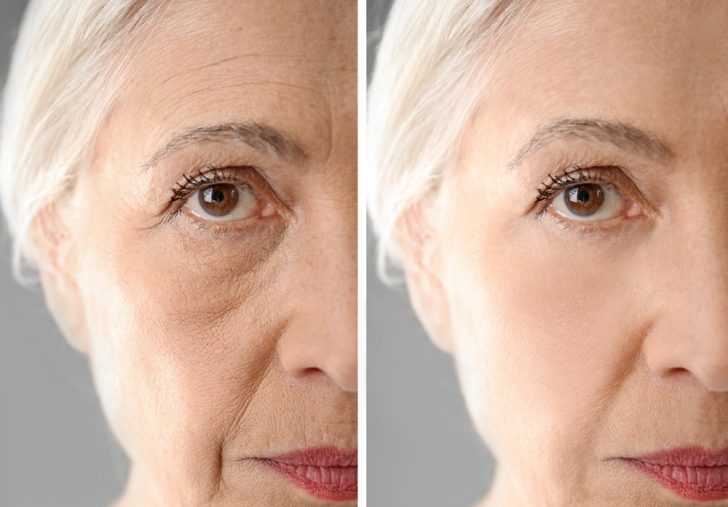 collagen effect on aging skin