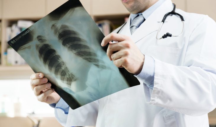 Doctor Looking at X-Ray