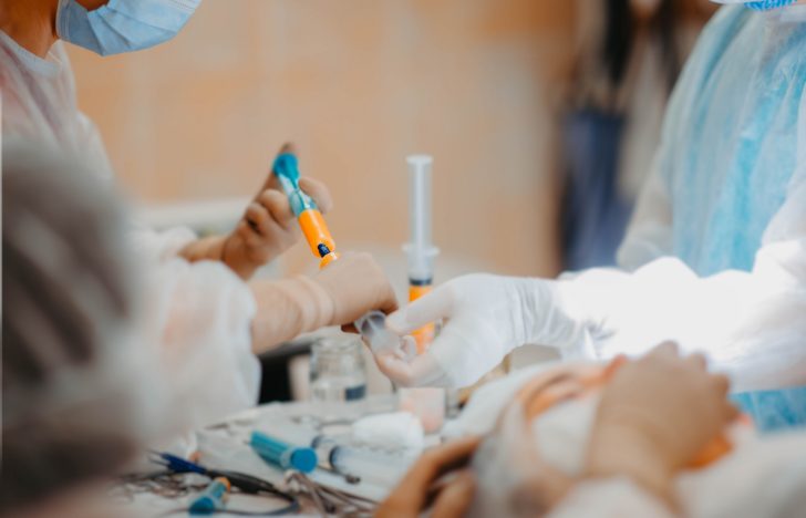 skin grafting