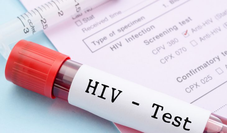 HIV test