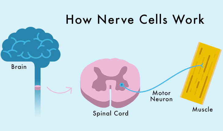 Muscular atrophy. Spinal muscular Atrophy. Sma Symptoms. Spinal muscular Atrophy pictures. How to know if you have muscle Atrophy.