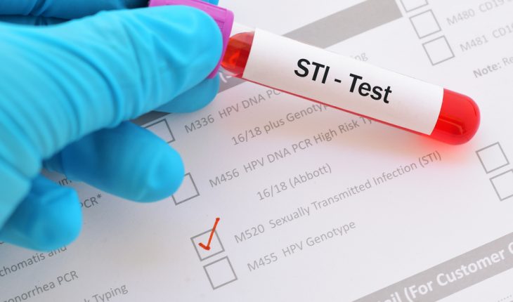 STI test