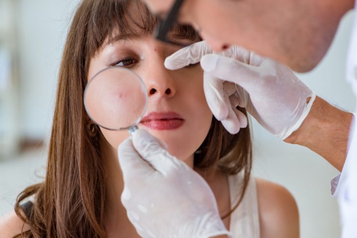 skin examination with magnifying glass