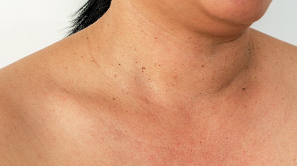 How to Care for Your Skin during Radiation Therapy LaptrinhX / News