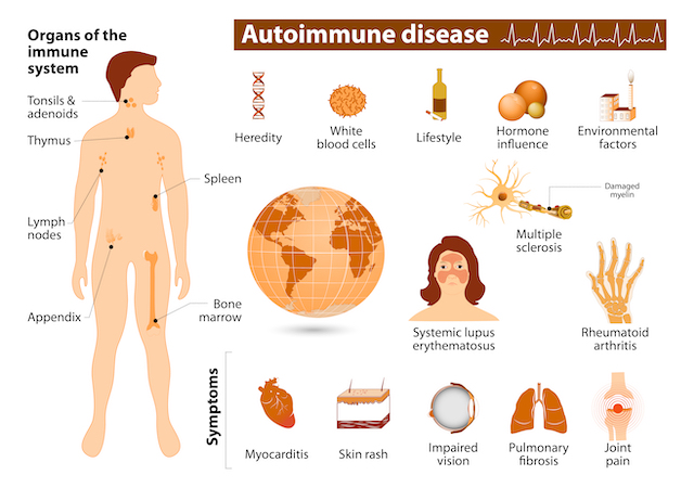 autoimmune