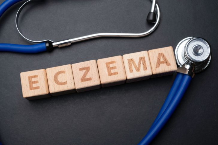 eczema
