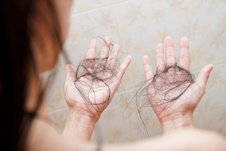female hair loss