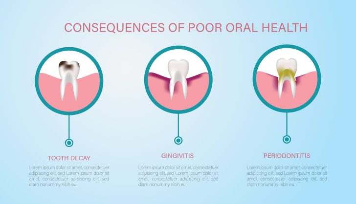 Poor oral health may contribute to declines in brain health