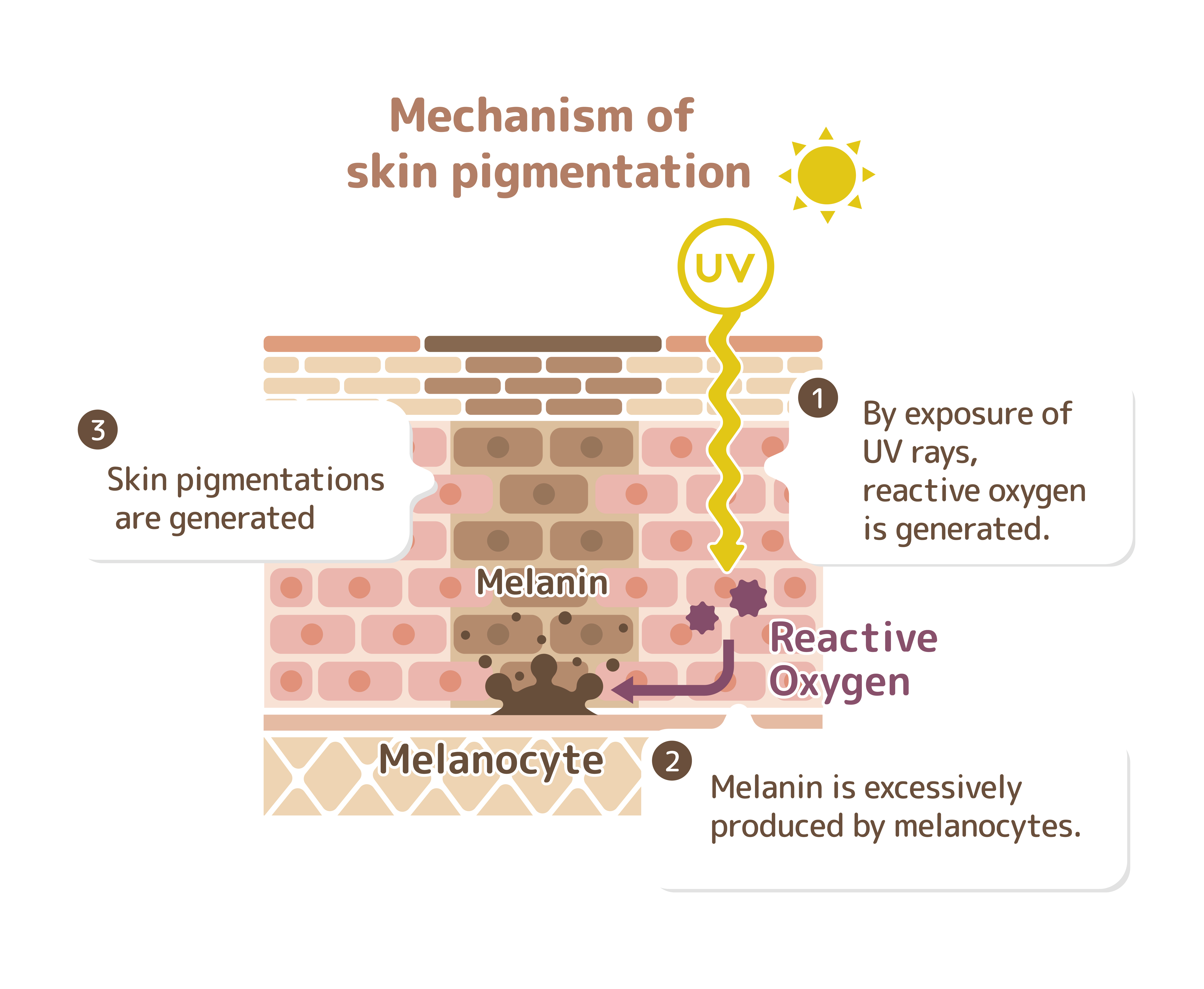 hydroxychloroquine-induced-hyperpigmentation-of-the-skin-the-journal