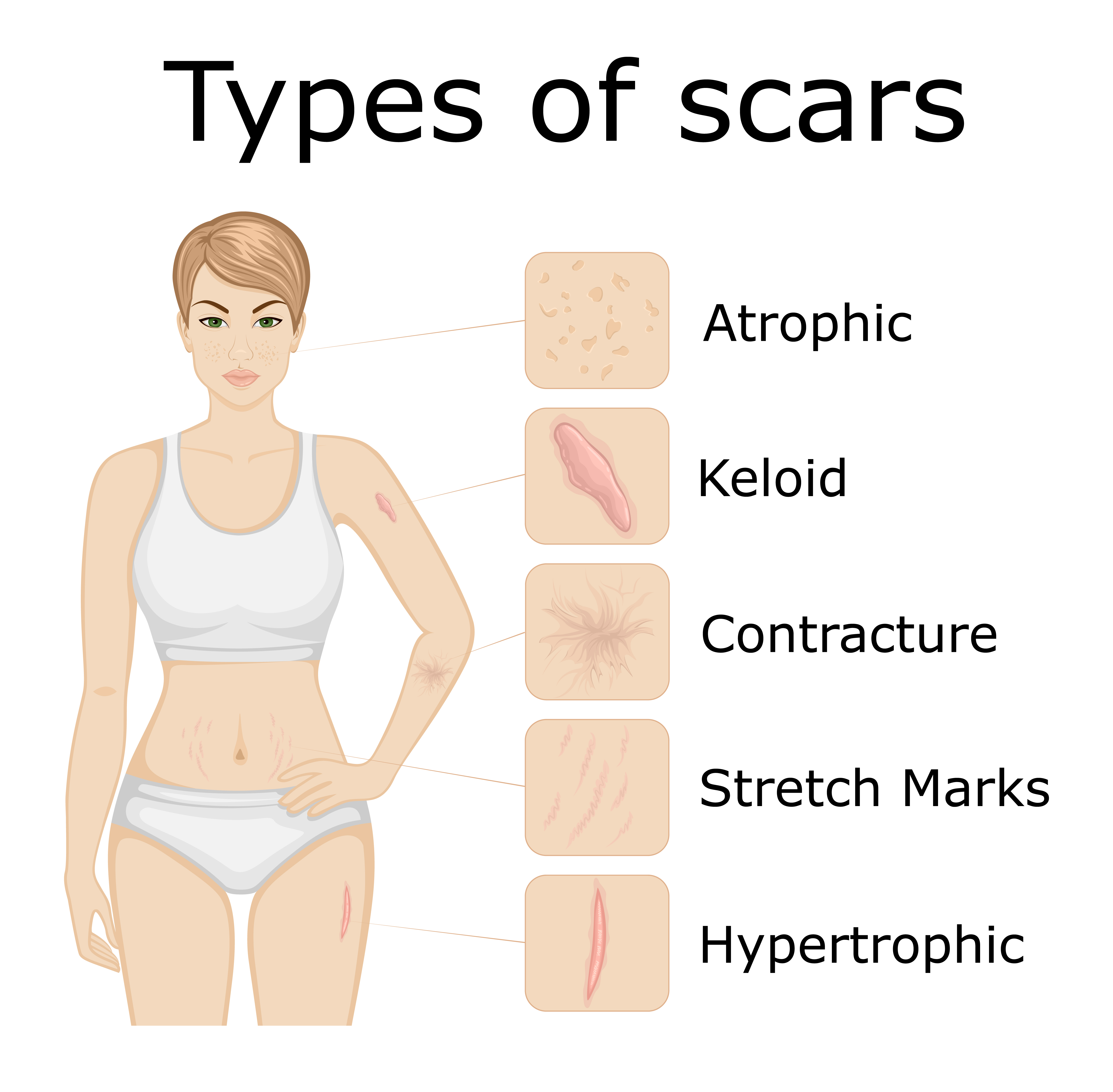 What Causes Black Scars On Skin